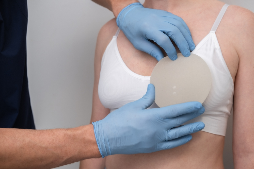 Brustvergrößerung mit Implantaten