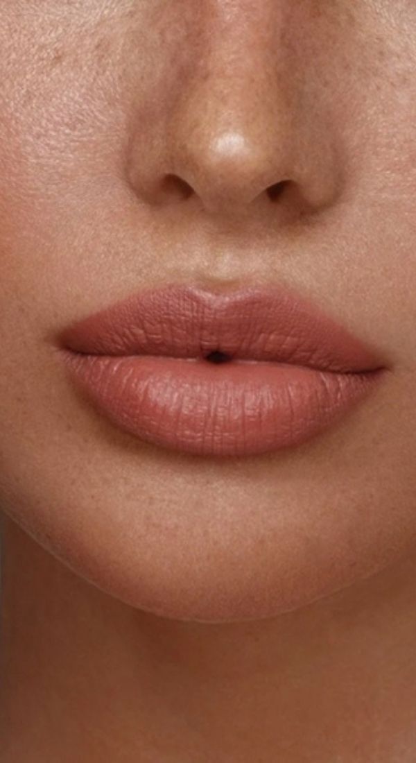 Implantats Austausch Brust